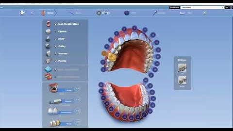 Import/Export STL Files in Romexis