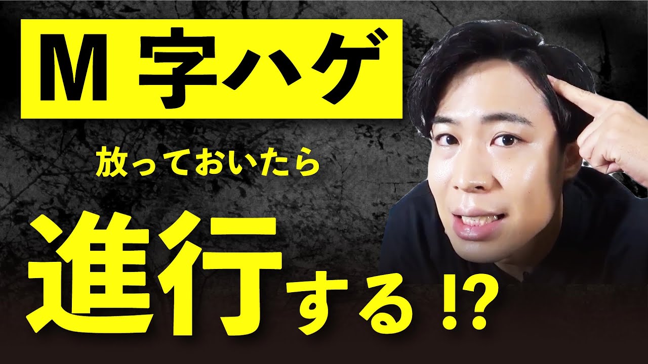 M字ハゲは進行する ドラックストアで買うべき育毛剤と唯一効果のあるシャンプーについて 美容師 髪技屋さんの 髪ブログ