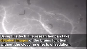 Mini Microscope is the New GoPro for Studies of Brain Disease in Living Mice