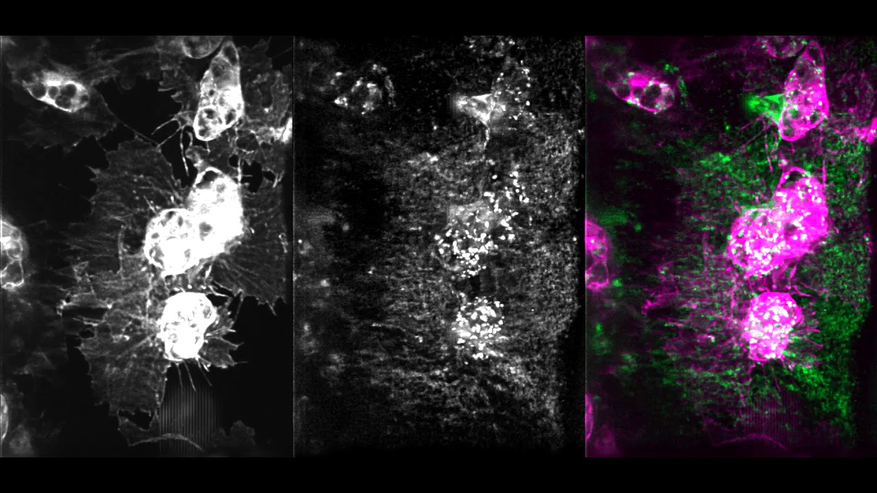 Drosophila hemocytes