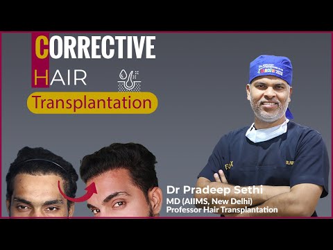 Corrective Hair Transplantation
