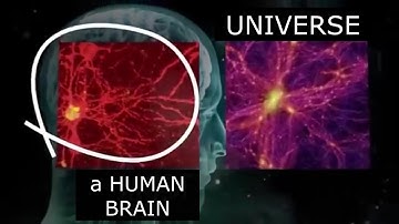 A HUMAN BRAIN and the UNIVERSE. Microcosm & Macrocosm
