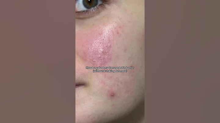 How to Repair Skin Barrier #skincare #skincareroutine #shorts