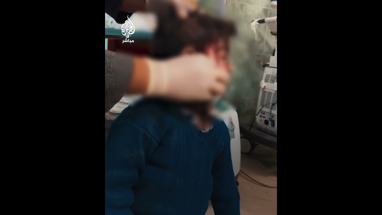 "بخافش".. طفل فلسطيني أثناء علاجه من إصابته إثر غارات الاحتلال الإسرائيلي