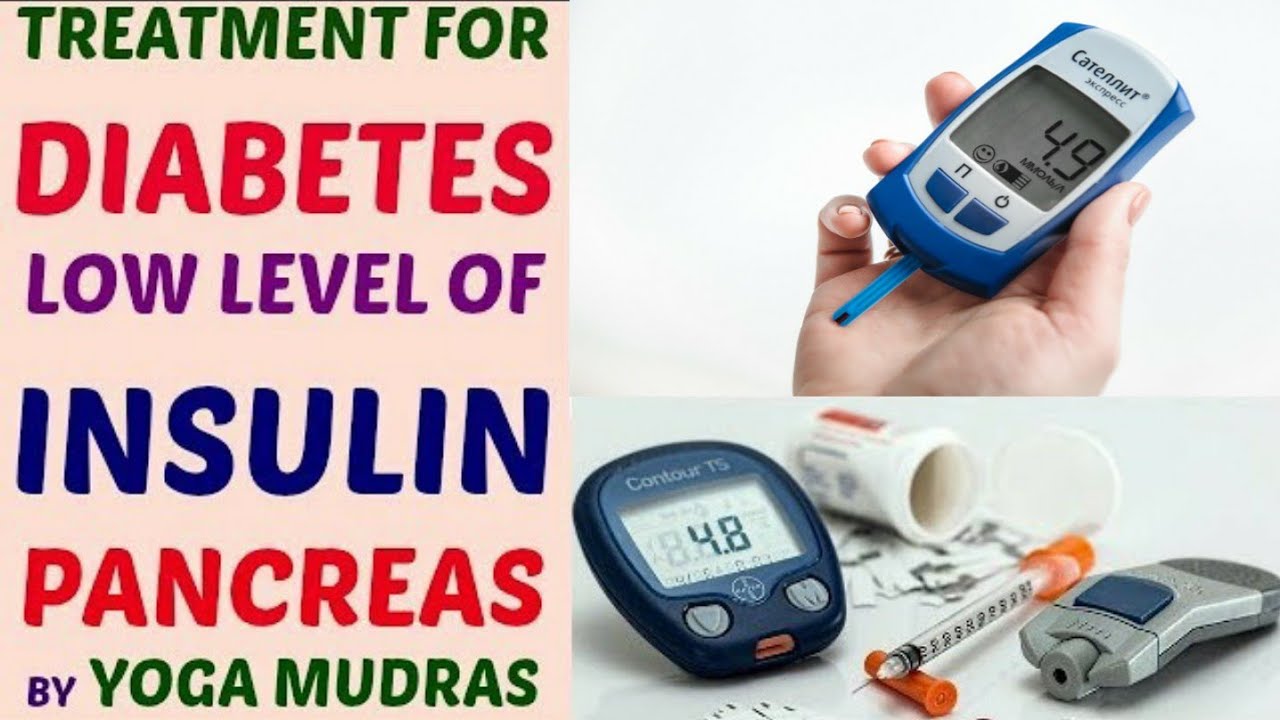 Treatment for Diabetes Sugar Problem Low Insulin by Yoga Mudra Video in
