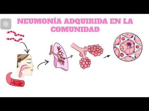 Fisiopatología de la