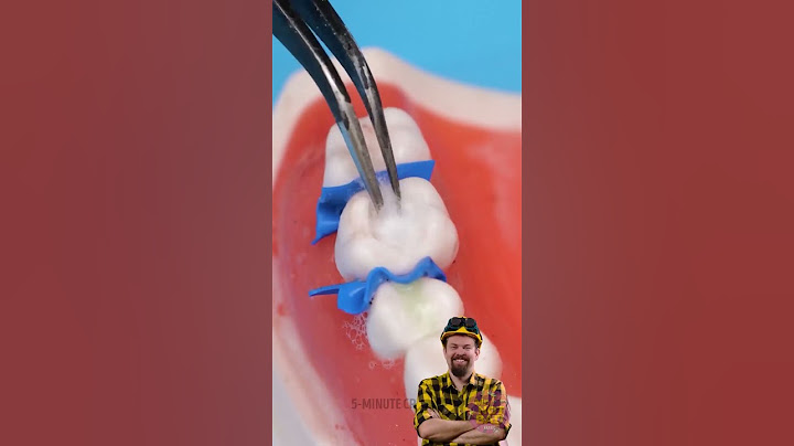 كيف تبدو عملية إزالة التسوس من وجهة نظر الطبيب! 🦷👀✨ رد فعل بوتش!