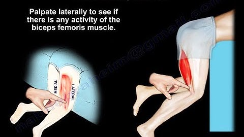 Clinical Evaluation of the Hamstring Muscles - Everything You Need To Know - Dr. Nabil Ebraheim