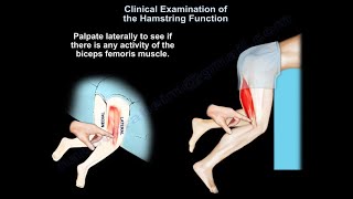 Clinical Evaluation of the Hamstring Muscles - Everything You Need To Know - Dr. Nabil Ebraheim