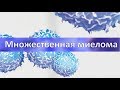 Множественная миелома