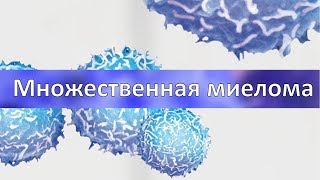 Множественная миелома