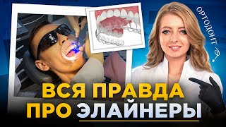 видео: Показываем процесс установки элайнеров на реальном пациенте картинка: Показываем процесс установки элайнеров на реальном пациенте