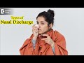 Types of Nasal Discharge & its meaning. When to be careful? - Dr. Harihara Murthy | Doctors' Circle