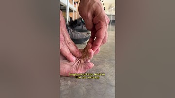 How To Deal With Toe Cramps