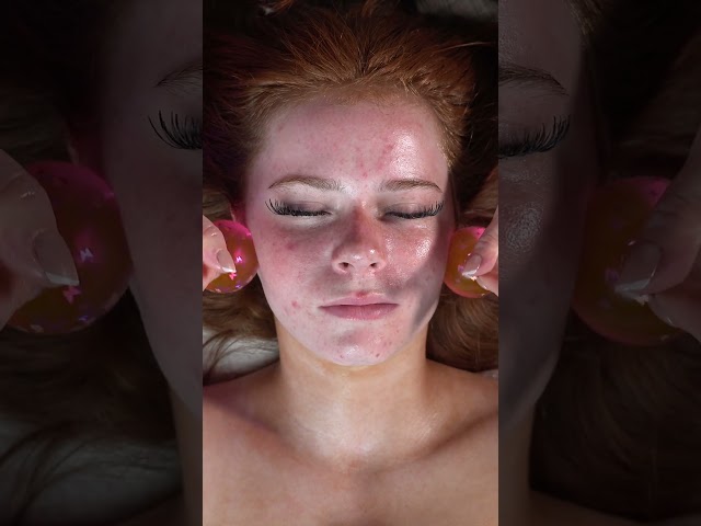 ASMR Acne Facial with Harper Zilmer #asmrfacial
