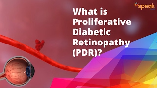 What is Proliferative Diabetic Retinopathy (PDR)?