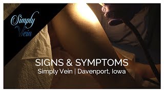 Signs Symptoms Dr. William Olson Of Simply Vein