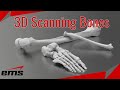 3D Scanning Bones