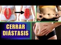 CERRAR LA DIASTASIS ABDOMINAL ✅ Eimina el Vientre Abultado,