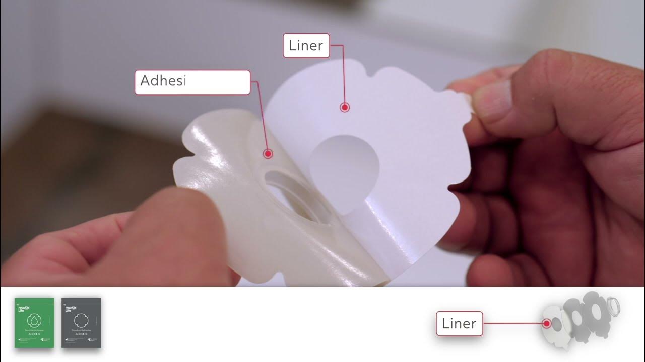 Features & Benefits of the Provox Life Adhesive Range for Patients with