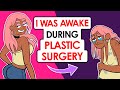 I Was Awake During Plastic Surgery At Age 16 (I became a monster) | This is my story