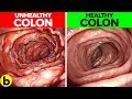 14 Effective Ways You Can Maintain A Healthy Colon