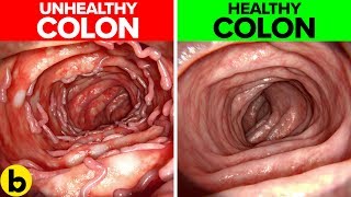 14 Life Changing Ways To Keep Your Colon Healthy