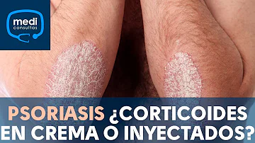 ¿Qué crema es mejor para la psoriasis?