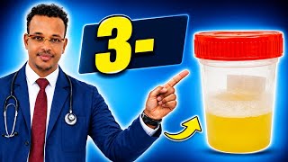 Foamy Urine | 3-Sabab Oo Keena Kaadi Xumbo Leh