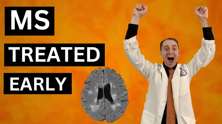 Multiple Sclerosis Treated Early and Aggressively