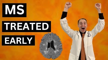 Multiple Sclerosis Treated Early and Aggressively