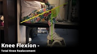 Total Knee Replacement Using A Rolling Pin And Step To Improve Flexion