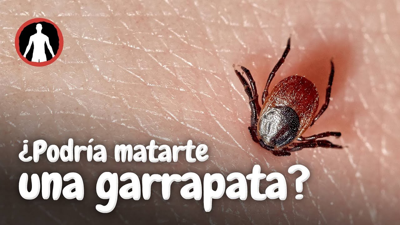 Qu Pasa En Tu Cuerpo Cuando Te Pica Una Garrapata YouTube qu-pasa-en-tu-cuerpo-cuando-te-pica-una-garrapata-youtube