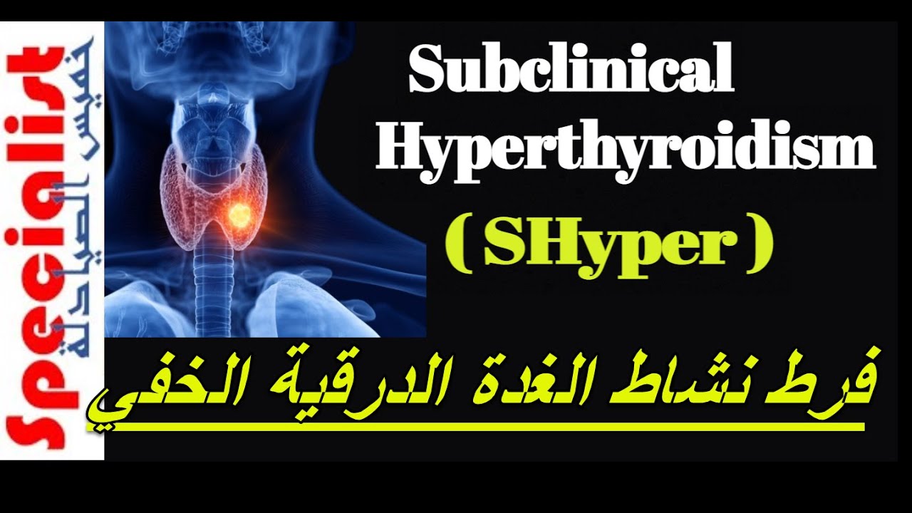 SHyper| فرط نشاط الغدة الدرقية الخفي | الاسباب | الاعراض | العلاجات