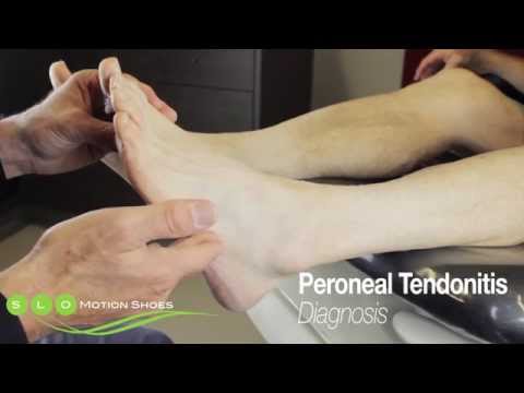 Video: Ko liječi peronealni tendonitis?