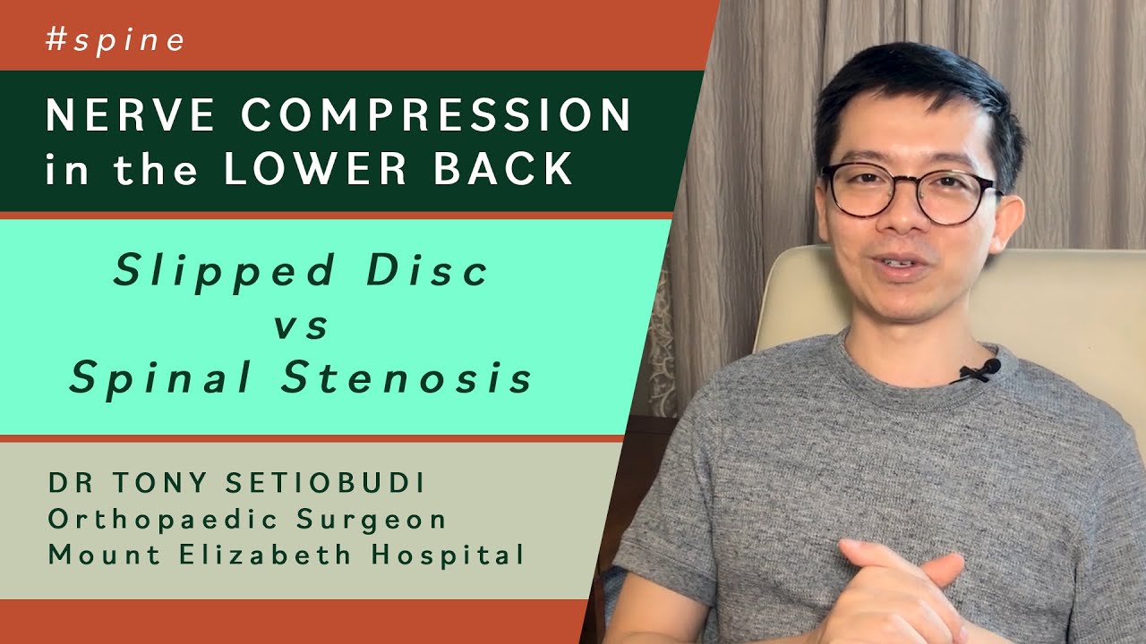 LUMBAR NERVE COMPRESSION SLIPPED DISC VS SPINAL STENOSIS YouTube