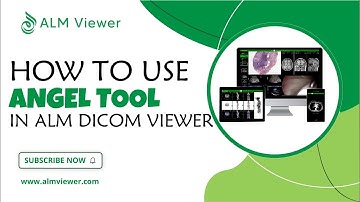 How to Use Angel Tool in ALM Dicom Viewer | By Alm Viewer
