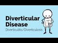 Diverticular Disease | Diverticulitis | Gastrointestinal Society