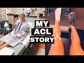 MY ACL RECOVERY STORY | D1 COLLEGE SOCCER