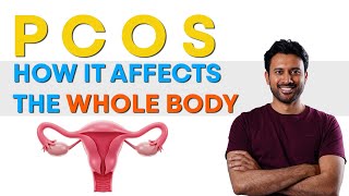 How PCOS Causes Irregular Periods & Hormonal Chaos | Dietitian’s Guide