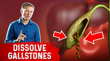 Do This to Help Dissolve Gallstones