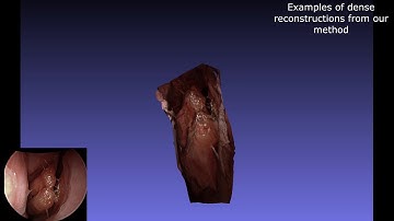 Self-supervised Learning for Dense Depth Estimation in Monocular Endoscopy