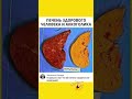 #шуточное #рек #смехпродлеваетжизнь