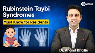 Rubinstein Taybi Syndromes Explained By Dr. Anand Bhatia