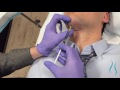 Male treatments at jandali plastic surgery