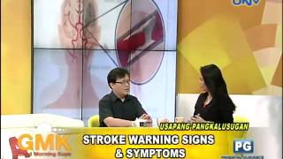 Warning Signs and Symptoms of Stroke