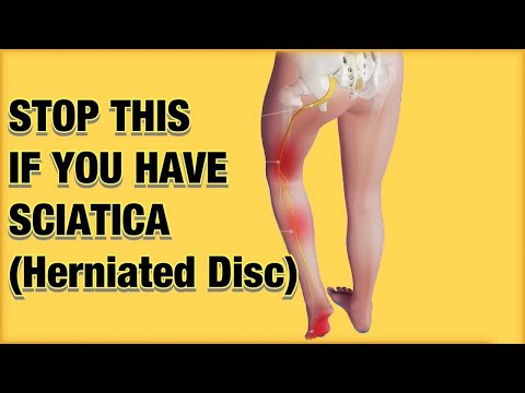 Sciatica Without Surgery , Ask A Physio (Herniated Disc)
