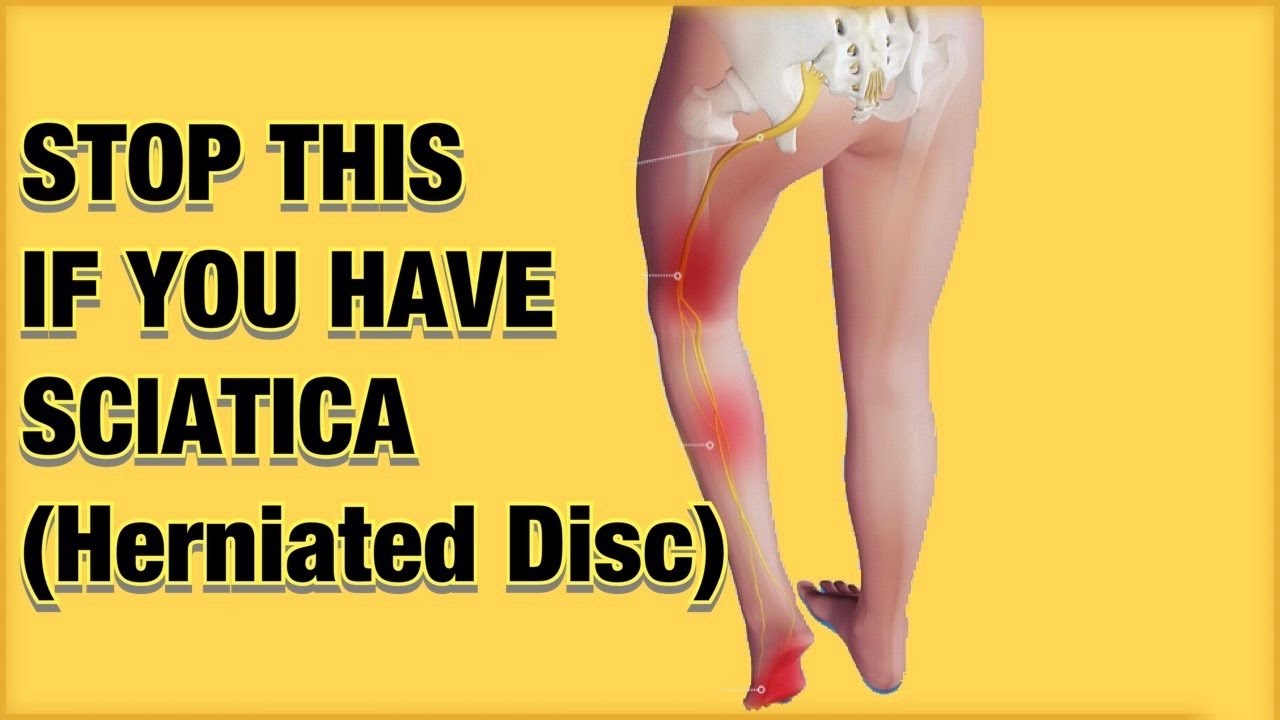 Sciatica Fix Without Surgery (Herniated Disc) - Capital Physiotherapy