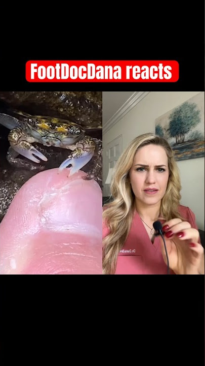 Doctor reacts: crab pedicure