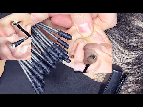 또 레전드 asmr 😴 진짜ㅠ 이건 보셔야 합니다 귀청소 (자막 있슈) real super ear cleaning #58